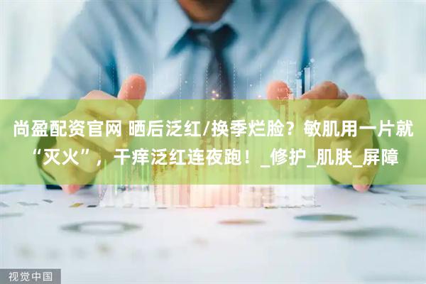 尚盈配资官网 晒后泛红/换季烂脸？敏肌用一片就“灭火”，干痒泛红连夜跑！_修护_肌肤_屏障